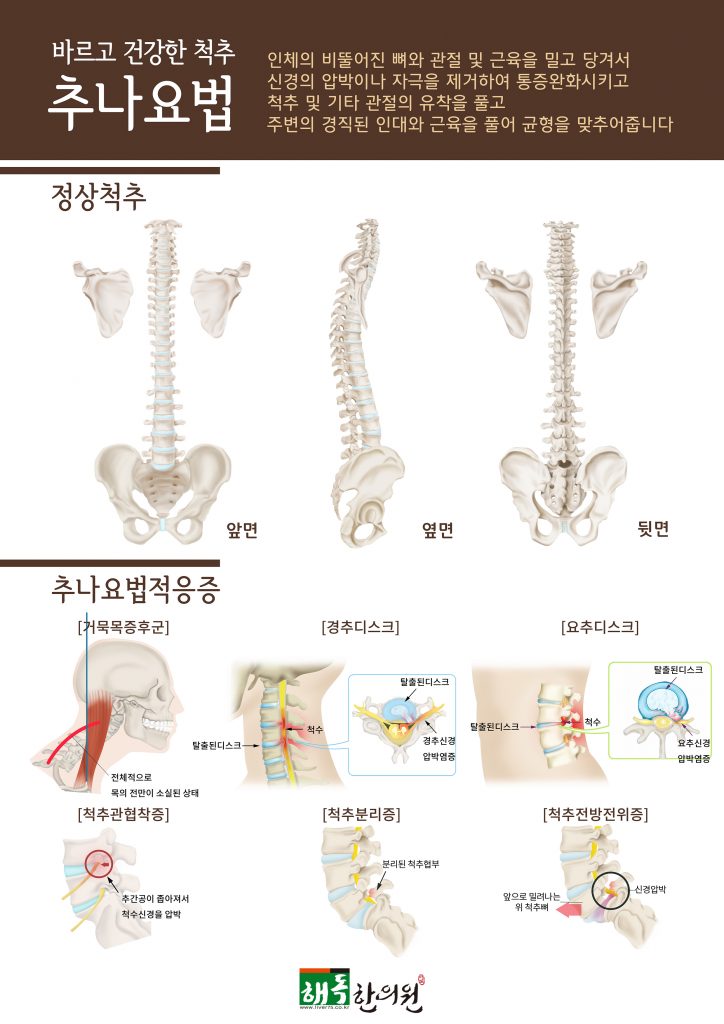 교통사고치료 2