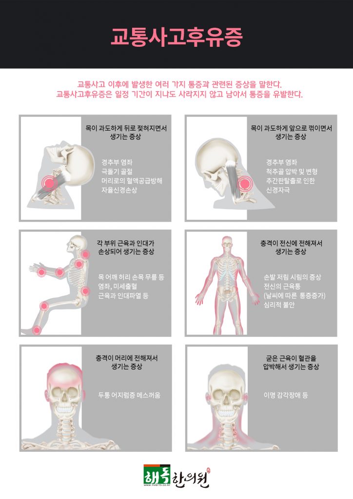 교통사고치료 1
