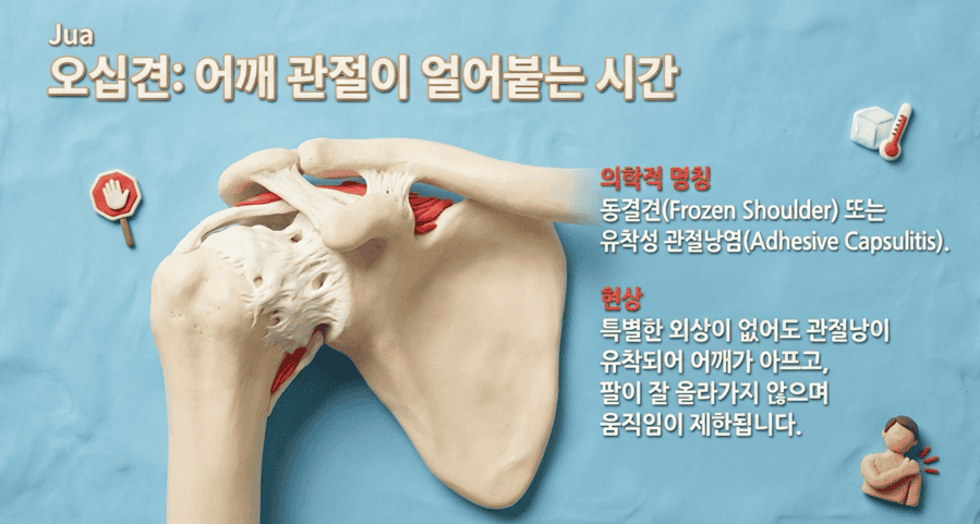 공릉동한의원 오십견 동결견 어깨 통증 증상 설명 이미지